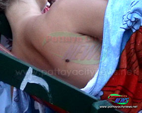 Фото. Ранение1.