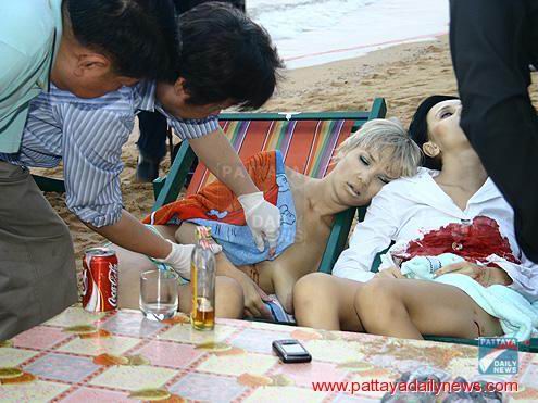 Фото. Ранение2.